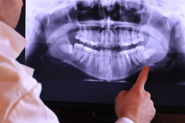 Best Pediatric Emergency Dentist in Shoreview, MN