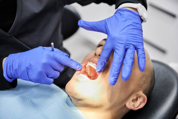 Best Emergency Gum Treatment in Shoreview, MN