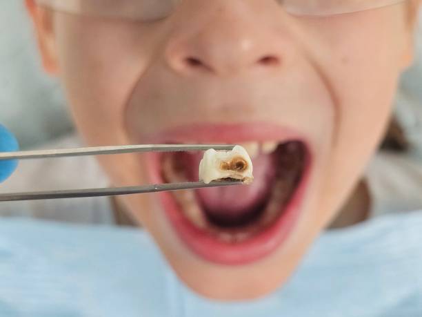 Best Cosmetic Emergency Dentistry in Shoreview, MN